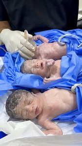 42K views · 1.7K reactions | #triplet #baby first breath  | Dr islam babydoctor | Facebook