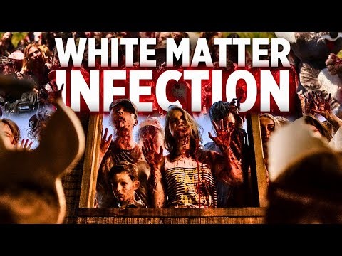 The Zombie Neuronal Infection In Little Monsters (2019) Explained