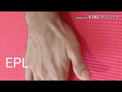 outcropping muscles of forearm, thumb extensor muscles, APL, EPB, EPL