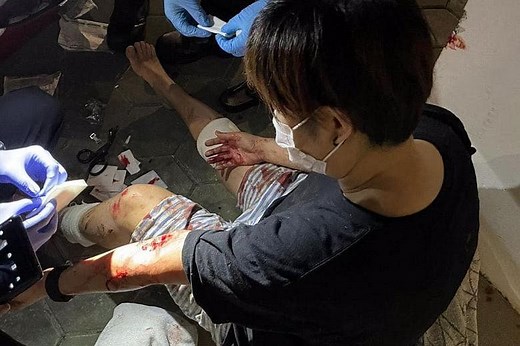 Punggol residents shocked after 2 wild boar attacks in a night