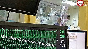 Njega vrta: Upute: Ispitivanje Tla - Odredite Ph Vrijednost Travnjaka Sami - Izvršite Ispitivanje Tla U Vrtu | 2025