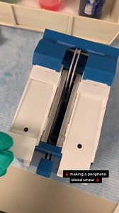 387K views · 4.5K reactions | Automated blood smear preparations  #lablife #hematology | Lab life | Facebook