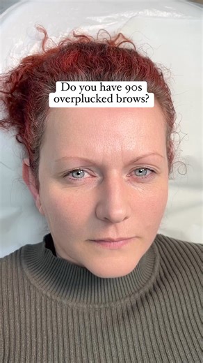 Do you have 90s overplucked brows? #90sbrows #thinbrows #eyebrows #naturaleyebrows #microblading #browtransformation | Sculpt Spmu
