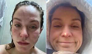 Vicky Pattison opens up about health issue as doctors find 4cm cyst on her ovary - Extra.ie