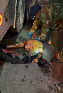 Super Gory Motorcycle Accident In Cambodia