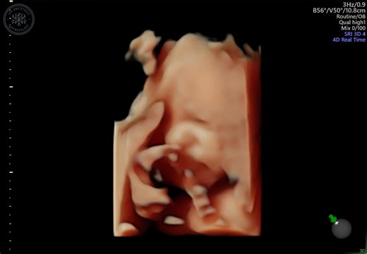 BIIIIIG yawn 🥱 I guess this handsome little 🩵BOY🩵 is tired after the West Highland Way! We were hoping to wait until delivery to find out what we were having, but an ultrasound tech slipped up and kinda spilled the beans. Anyway, we are thrilled and only have about 9 more weeks until we get to see his sweet little face in person 😅 | Homemade Wanderlust