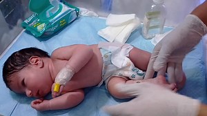 5.4K views · 85 reactions | Neonatal Sepsis Explained | Symptoms, Causes & Treatment #shortfeed #cute #niculife #newborn | Anoop Gautam | Facebook