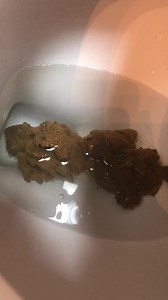 3000+ Calories of Morning Diarrhea (Huge)