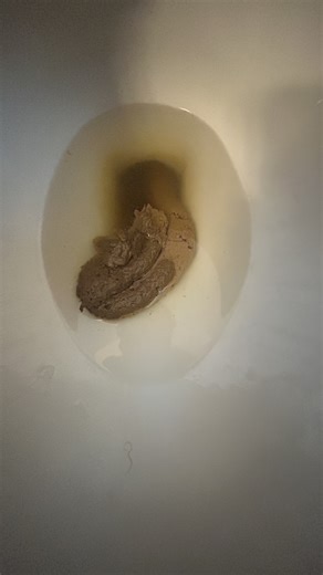 1/12/26 - Birthday Poop