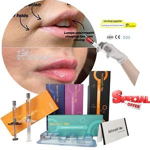 [Hot Item] Korea Most Popular Facial Filler Hyaluronic Acid Injection Dermal Filler for Face