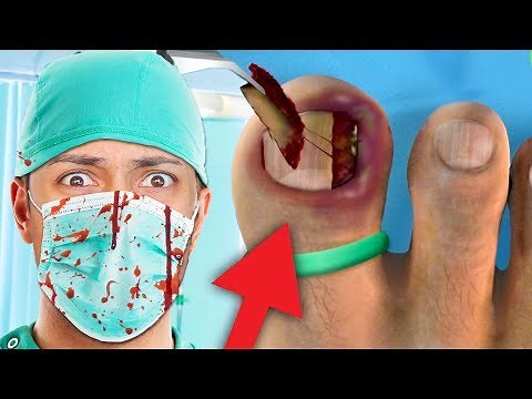 MOST DISGUSTING GAME EVER MADE !!! (Ingrown Toenail Surgery Game)