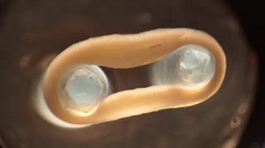 Did you miss #JACC video of 3D beating engineered heart muscle in Takotsubo syndrome pt? Check out: http://ow.ly/yeTy30f2Qsl Uni Göttingen | JACC Journals