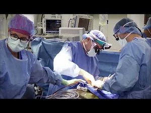 HeartMate 3 LVAD - Preparing the Left Ventricular Inflow Cannula Site