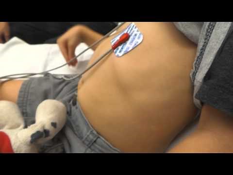 Intercostal Retractions and Probable Enterovirus D68 Infection