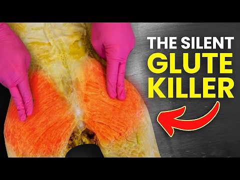 The Reason You Have a Huge Butt and How to Train It.