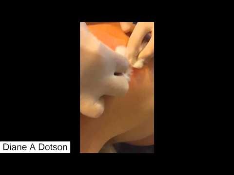 My Volcanic ZIT ( zits on my back) - All pimples of the world - 2