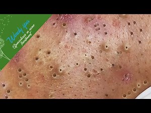 Make Your Day Relaxing with Windy Spa 6#15