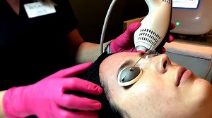 Save $100 on this amazing skin rejuvenation treatment - Clear Brilliant! CatalystSpaSpecials.com | Catalyst Medical Center Clinical Spa