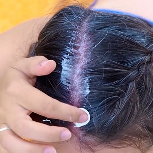 49K views · 88 reactions | First aid summer hacks everyone should know! | 5-Minute Crafts Play | Facebook