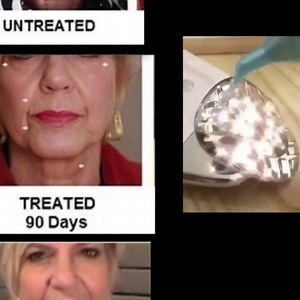 Con Galvanic Spa puedes mantenerte joven sin perder tu esencia Solo adquiere hoy este hábito que cambiará tu rostro y tu vida en forma natural sin perder tu esencia #spaencasa#antiagechile#esteticachile# | Atrévete a ser regia con Alma Carioca