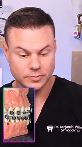 It’s giving nightmare fuel at the dentist’s office 😮🦷 #DentalHygienistWeek #OrthoLife #FunnyDentist #SmileGoals | TheBentistofficial