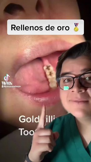 Gold Dental Fillings: Close-Up Look at Unique Treatment
