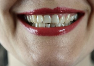 Do I need to floss my teeth?