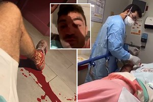 Mike Perry has fans fearing for his health as he lies on floor covered in blood