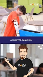 3D printed bionic arm | Startup Selfie