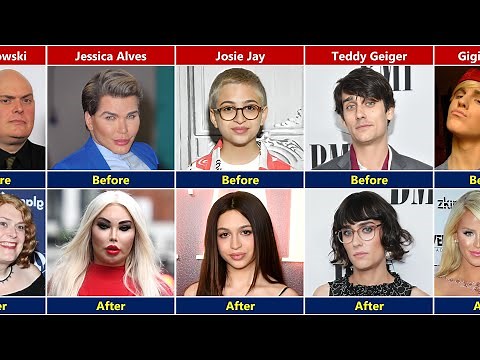 Celebrities Who Underwent Gender Transition | Before and After