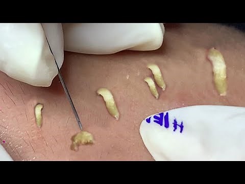 Satisfying Hien Spa Beauty Relaxing Video #25