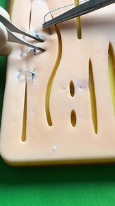 Inverting horizontal mattress suture | Dermhacks