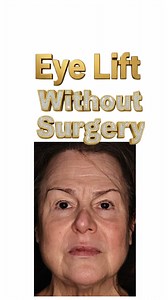 1.1K views · 5 comments | ✨ The Erbium laser tightens and smooths the...