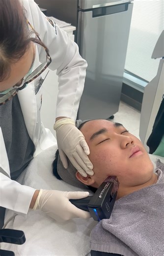 Morpheus8 RF Microneedling Machine🪡 Morpheus8 is a non-surgical advanced needling treatment. When we age, our skin begins to lose elasticity, with wrinkles, lines, and sagging appearing. Using radiofrequency, a Morpheus8 treatment stimulates collagen production to tighten and smooth wrinkles on the face and body. Morpheus8 comfortably penetrates the skin at a deeper level than other needling treatments, transforming your complexion and restoring more youthful facial skin. ▫️▫️▫️▫️▫️▫️▫️▫️▫️▫️▫️