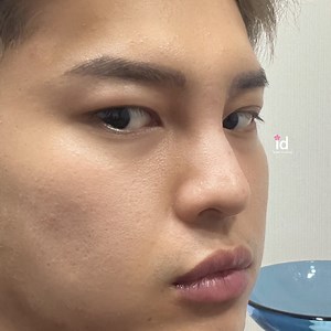 โรงพยาบาลศัลยกรรมไอดี - ID Hospital on Reels | Facebook