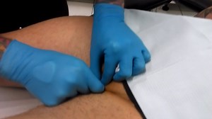 Vertical Clitoral Hood Piercing on FTM Transman