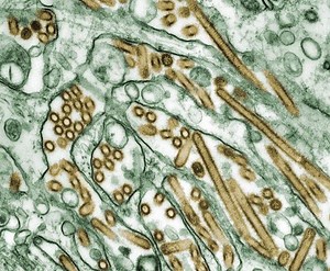 H5N1 Avian Flu ID'ed in a Variety of Bird Populations Worldwide | Microbiology