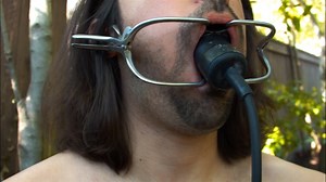 Dental open mouth gag with a rubber butterfly inflatable behind it