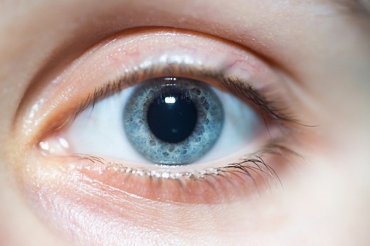 Mydriasis: definition, symptoms, causes, diagnosis and treatment