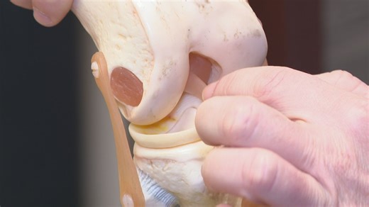 OrthoCincy surgeons warn delaying ACL treatment can cause lasting knee damage