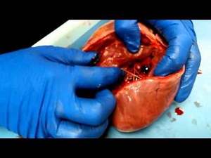 Deer Heart Dissection--Huschle