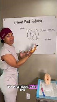 MUST-KNOW info 👇 Many patients ask if they’ll need a clitoral hood reduction—here’s our answer!