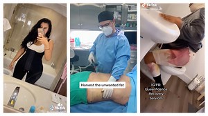 The BBL surgery 'that only the Kardashians could have' becomes dangerous TikTok trend