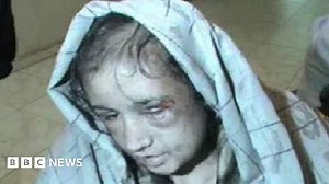 Afghan girl's 'horrifying abuse' exposed by video
