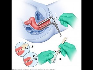 Pap Smear Technique