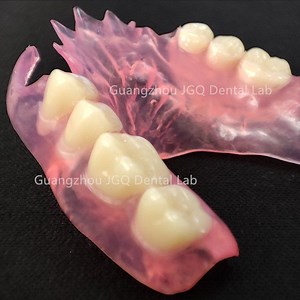 [Hot Item] Valplast Denture Teeth China Dental Lab Price Flexible Dentures Acrylic Removable