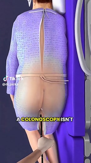 How Colonoscopy Is Performed | 3D Medical Animation #Colonoscopy #MedicalAnimation #DigestiveHealth #3DAnatomy #Endoscopy #HealthEducation #SafeMedicalContent