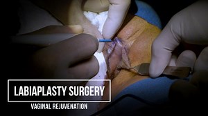 Labiaplasty Surgery - Vaginal Rejuvenation