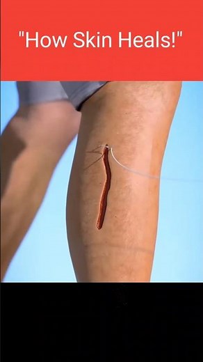 🔴 "How Stitches Heal Your Skin | Amazing Wound Healing Process Explained!"
