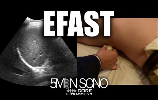 5 Min Sono – E-FAST - Core Ultrasound